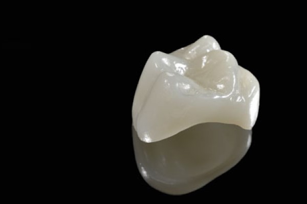 What Is The Most Popular Material For CEREC® Crowns?